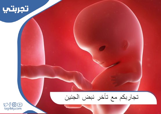 تجاربكم مع تأخر نبض الجنين