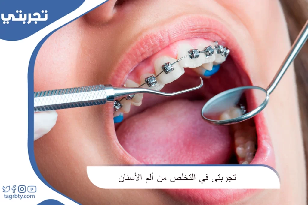 تجربتي في التخلص من ألم الأسنان