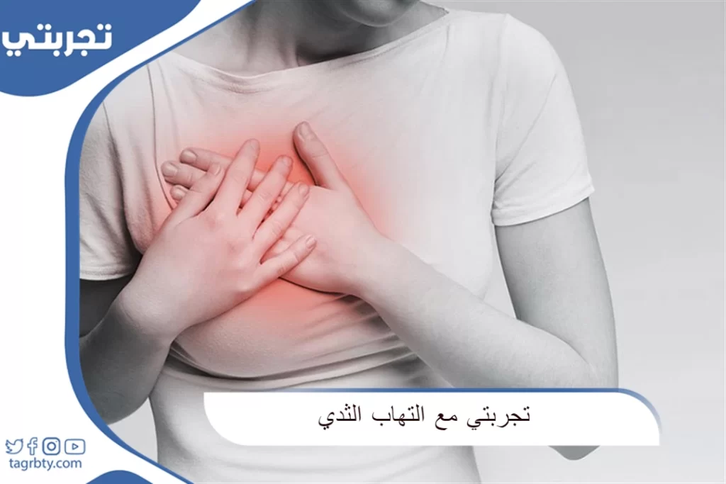 تجربتي مع التهاب الثدي
